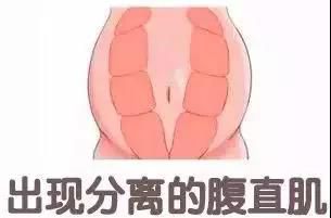 愛博恩醫(yī)學(xué)護理·引領(lǐng)產(chǎn)婦瘦身新浪潮