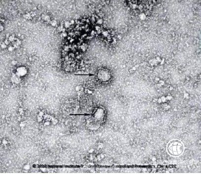疫情防控：減少外出更要改善室內(nèi)環(huán)境 