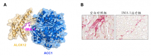  十年磨一劍 李紅良教授團隊研發(fā)非酒精性脂肪肝炎全新治療藥物