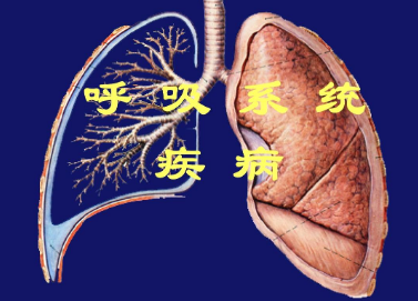 慢阻肺患者已達(dá)近億人 我國亟待提高呼吸系統(tǒng)疾病防治水平