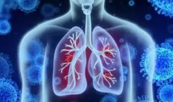 基本公共衛(wèi)生服務(wù)優(yōu)化擴(kuò)圍 規(guī)范開展慢阻肺病患者健康服務(wù)