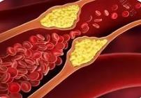 研究發(fā)現(xiàn)納米機器人可清除血栓