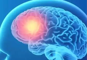 大規(guī)模臨床試驗證實：低風(fēng)險卒中患者監(jiān)測頻率可減半至17次