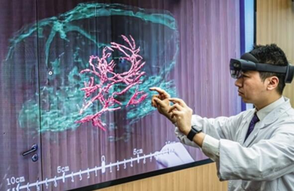 多因素催化 腦機(jī)接口產(chǎn)業(yè)發(fā)展迎躍遷