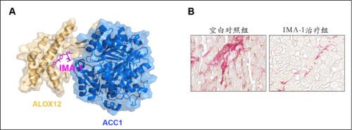 2021碩果累累 李紅良教授團隊在心血管代謝性疾病等領(lǐng)域連續(xù)取得重要進展